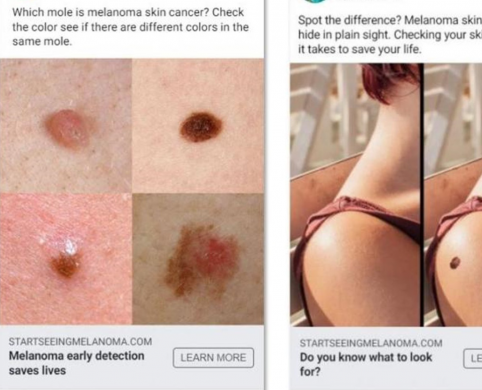 Three social media ads with images of melanoma and moles on skin.